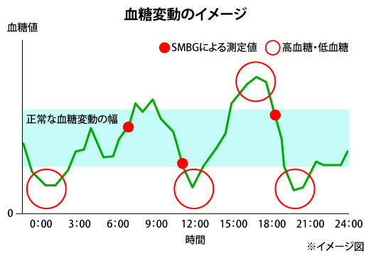 CGMで得られたデータに基づく血糖変動のグラフ イメージ図